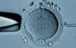 icsi modena