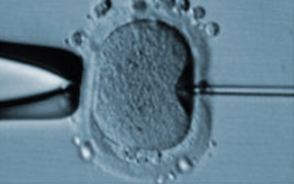 icsi modena