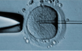 icsi modena