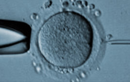 icsi modena